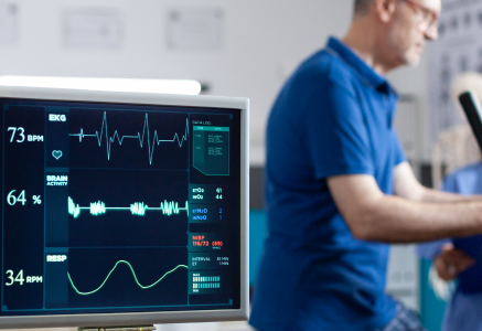 ECG